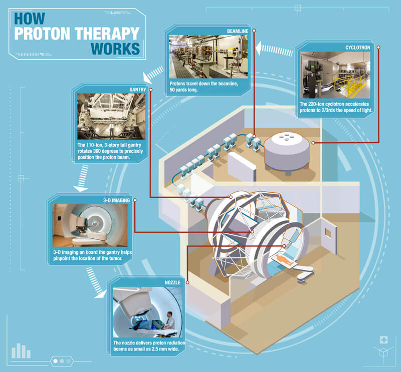 Cyclotron Proton Therapy